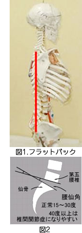 フラットバック